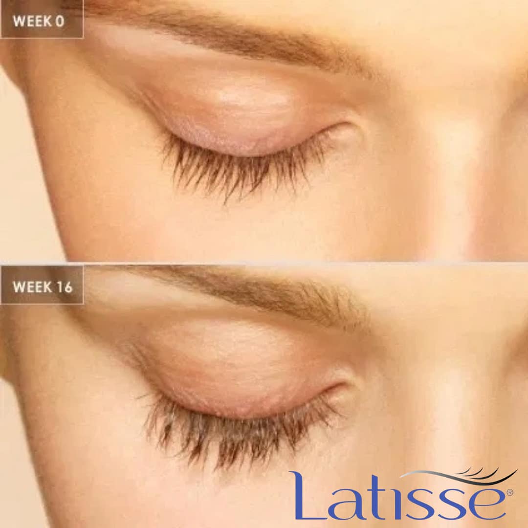 Facelift Overland Park Kansas